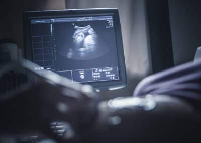 How the Concept of Fetal Viability Influences the Law